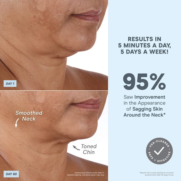 NuFACE 
NuFACE® Mini+ Petite Facial Toning Device