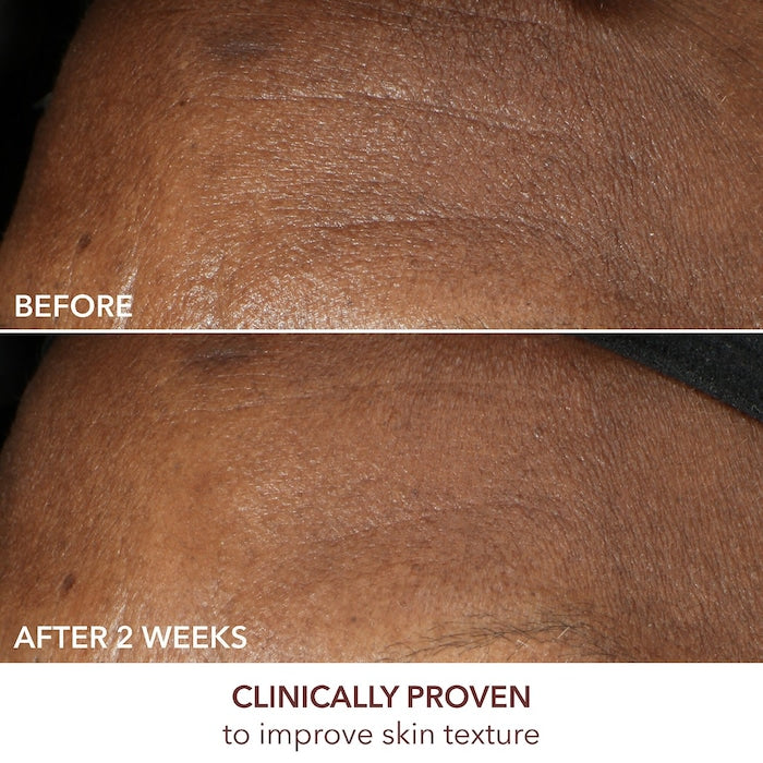 Dr. Dennis Gross Skincare 
Advanced Retinol + Ferulic Intense Wrinkle Cream