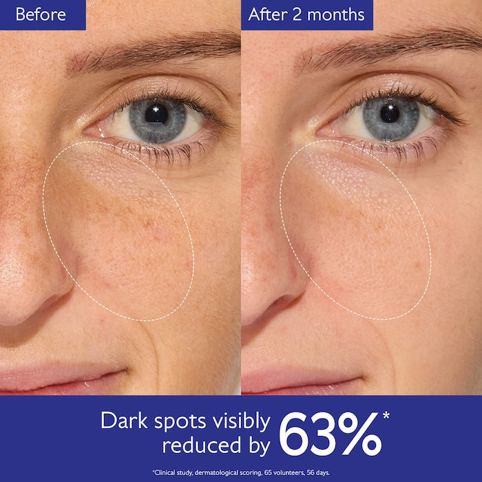 Caudalie 
Vinoperfect Brightening Dark Spot Serum Vitamin C Alternative