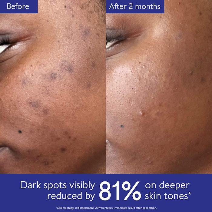 Caudalie 
Vinoperfect Brightening Dark Spot Serum Vitamin C Alternative